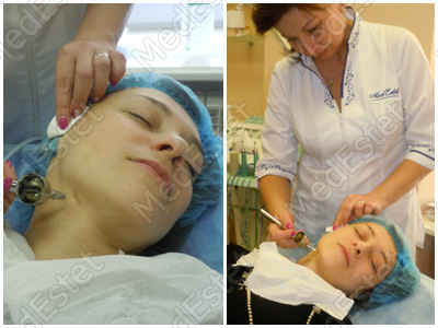 новый аппарат DermaOxy в МедЭстет