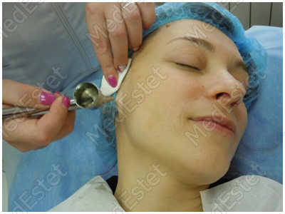 аппарат безинъекционной кислородной мезотерапии в действии