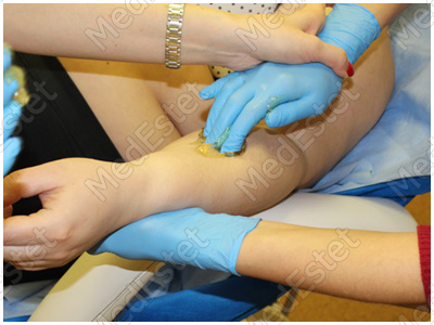 практическая часть обучения шугарингу в МедЭстет