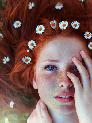 как появляются рыжие волосы