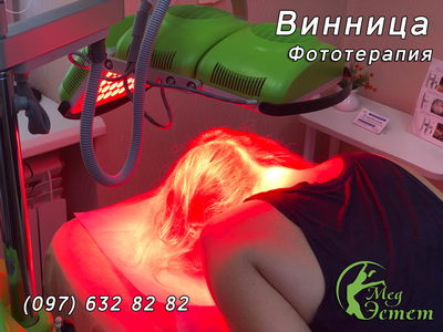 процедура фототерапия в виннице