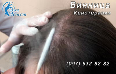 кріотерапія і вінниці