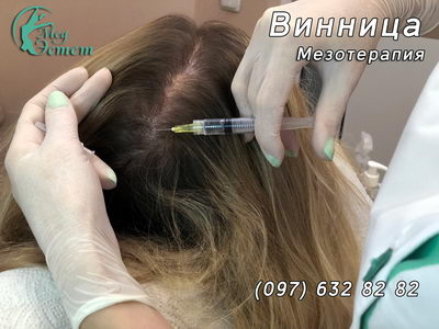 процедура мезотерапия в виннице 