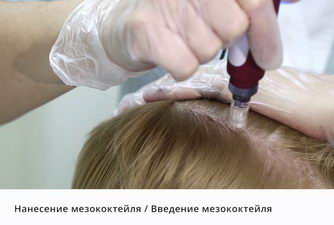 дермапен в виннице