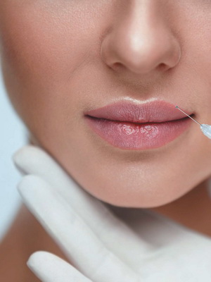 НЕХИРУРГИЧЕСКАЯ ПОДТЯЖКА ГУБ СО СМЕЩЕНИЕМ БУГОРКОВ