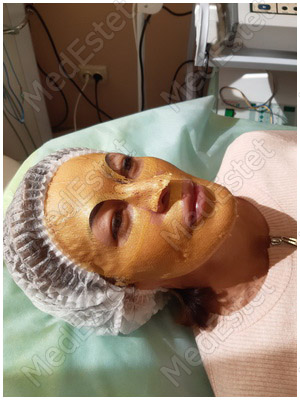 klapp золотое сияние