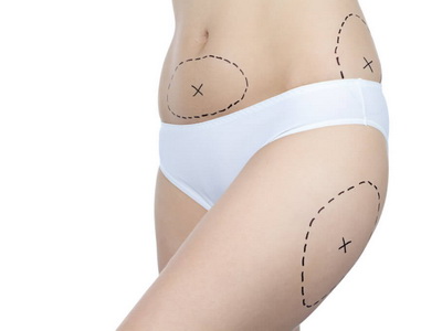 как убрать лишний жир