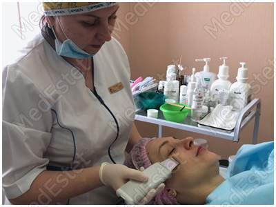 уход за лицом зимой в феврале