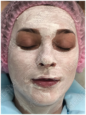 процедура по уходу за кожей