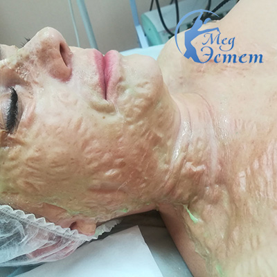 ферментная маска дмк