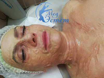 ферментная маска dmk