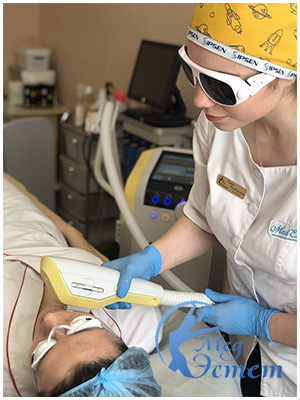 ipl exilite винница