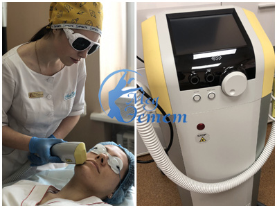 фототерапия Exilite