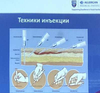 семинар от компании «Allergan»