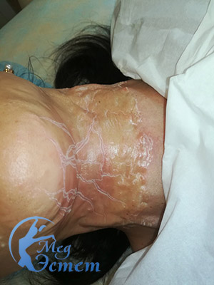 Силиконовые маски в виннице