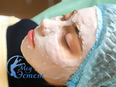 альгинатная маска в виннице