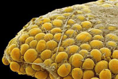 липолитики