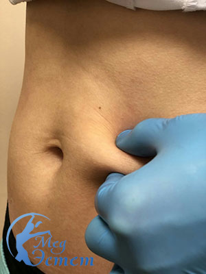 Белая жировая ткань 