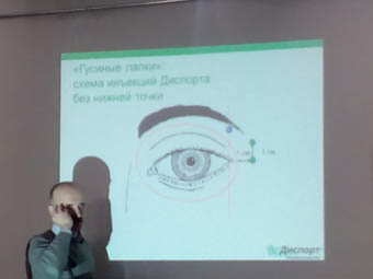 dysport botox Borodko Vinnitsa