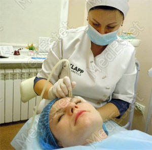 Дермаобразования - аппаратная шлифовка кожи в МедЭстет Винница