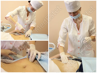 Revital Celluform в МедЭстет Винница