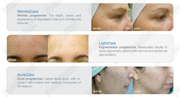 foto-tsveto-terapiya4